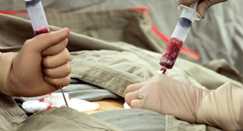 Faixa etária para transplante de medula em casos de doença falciforme é ampliada